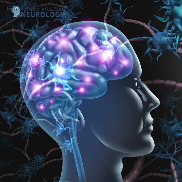 Illustration of a human head in profile showing a brain with glowing neural pathways and neurons, representing brain activity or common nerve disorders.
